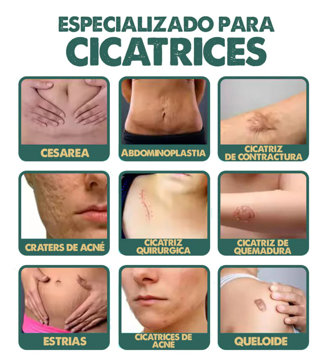 ✨ Spray Regenerador para Cicatrices