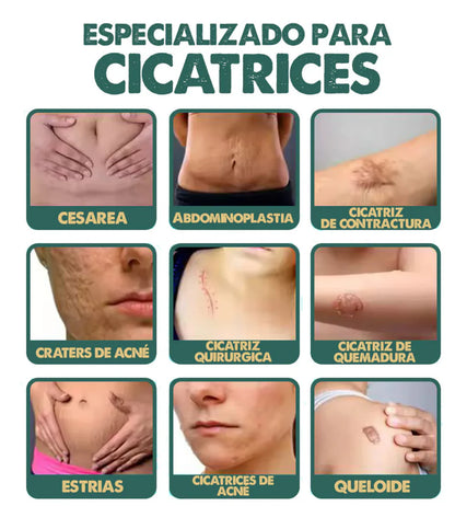 ✨ Spray Regenerador para Cicatrices